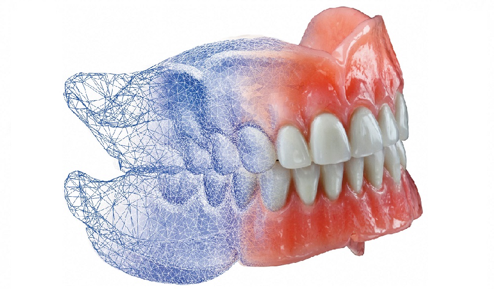 پرینت ۳ بعدی پروتز دندان