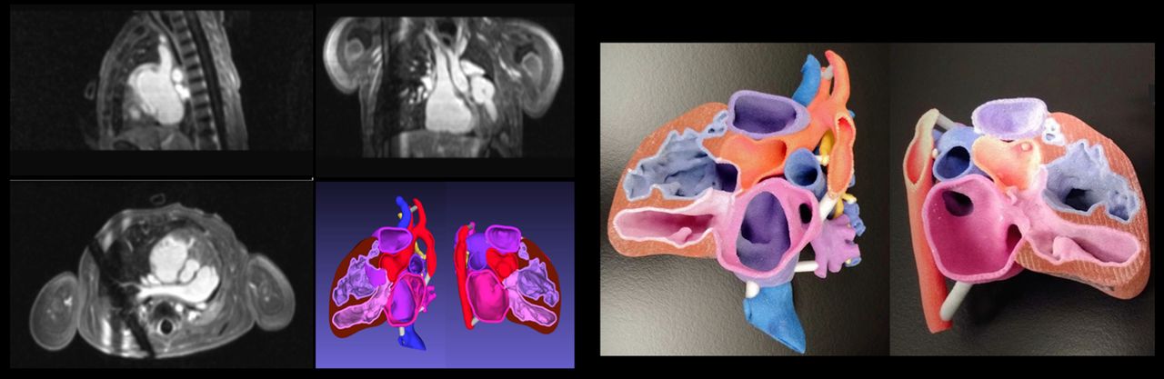 قلب پرینت سه بعدی- مدل hollow