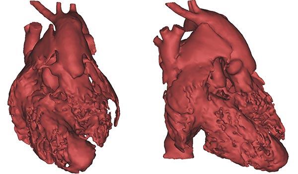 مدل سه بعدی قلب انسان