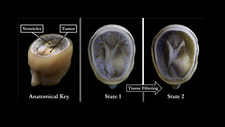 پرینت سه بعدی مدل مغز انسان در کمتر از ۱ ساعت