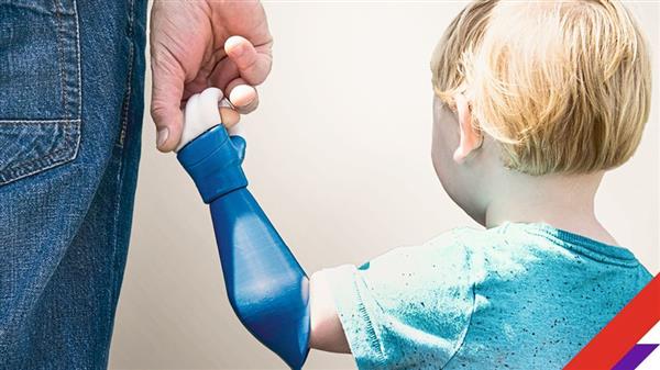 چاپ سه بعدی دست مصنوعی نوزاد توسط پدرش