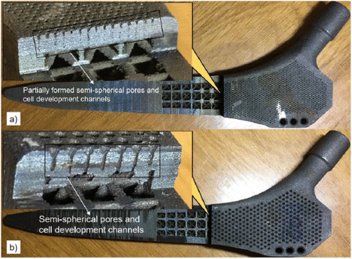 چاپ سه بعدی ایمپلنت های لگن