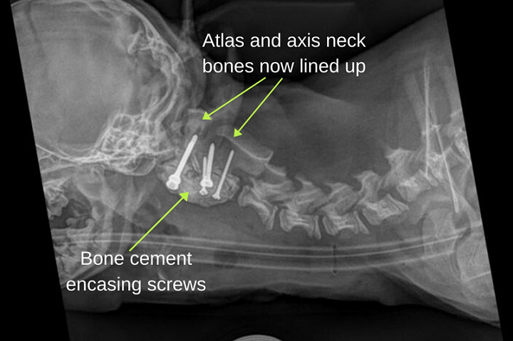 درمان فلجی یک سگ با استفاده از راهنمای عمل جراحی پرینت سه بعدی