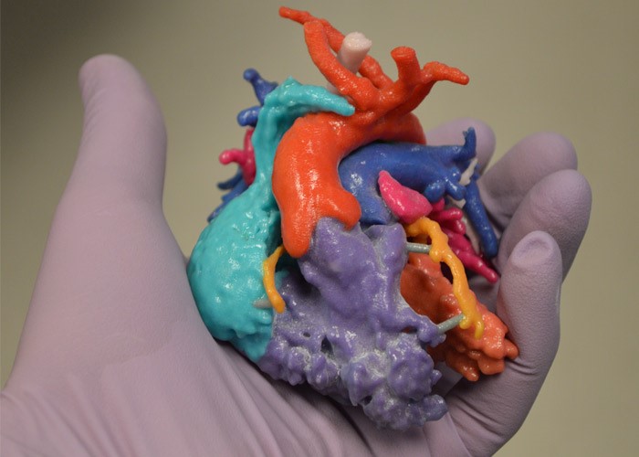 ساخت مدل های جراحی با استفاده از تکنولوژی پرینت سه بعدی