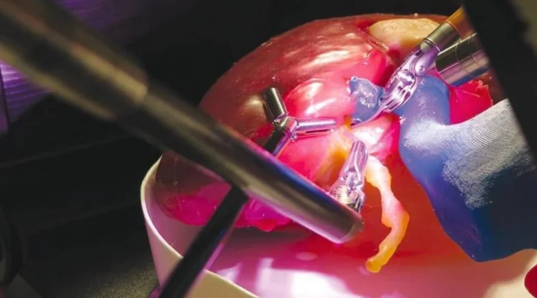 پرینت سه بعدی و شبیه سازی عمل جراحی توسط کاربر یوتیوب