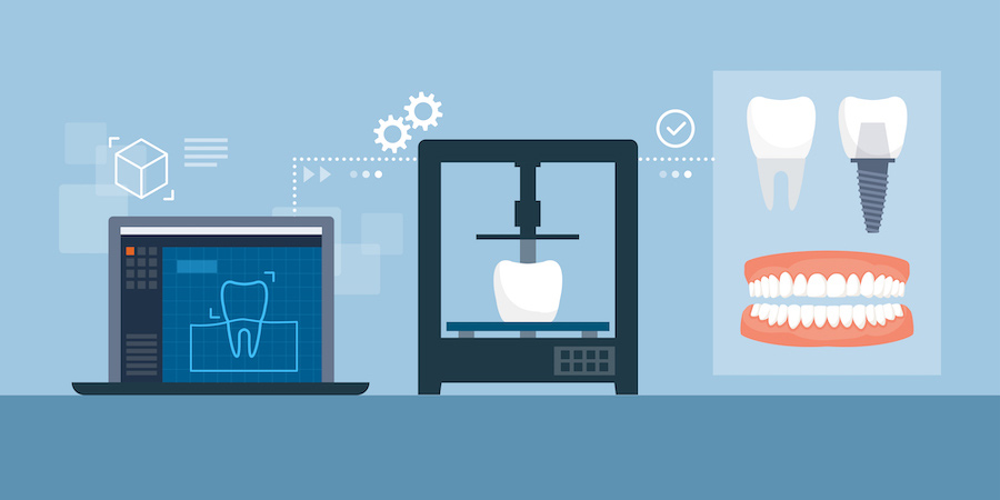 ویژگی های بهترین پرینتر سه بعدی دندانسازی